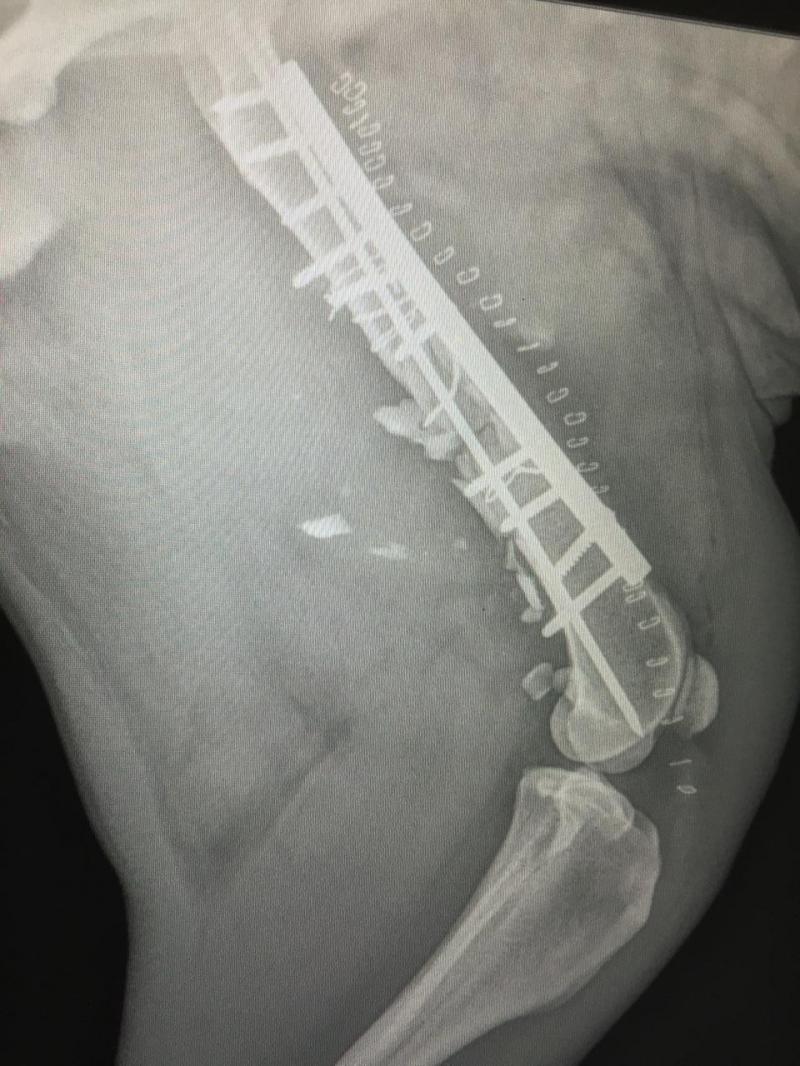 Canine fracture