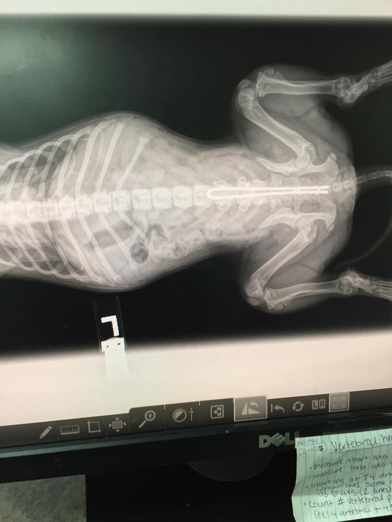Spinal injury